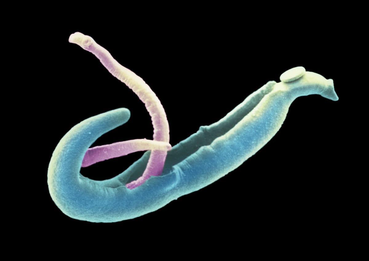 Embora a parasitose seja a causa mais comum de eosinófilos aumentados no sangue, não é a única causa