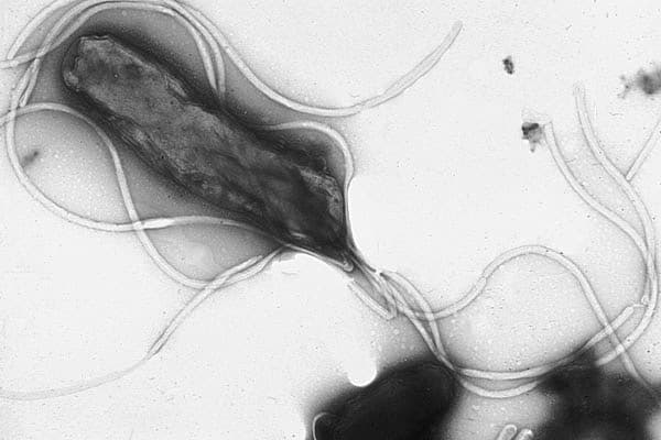Bactéria da Helicobacter pylori
